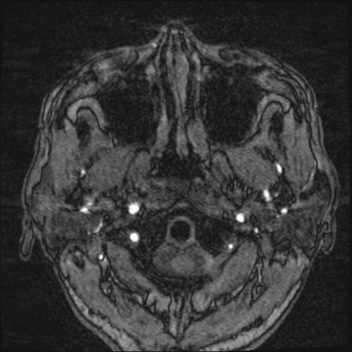 Click on the Serie image to view the images of VILLANUEVA, WILLIAM A.